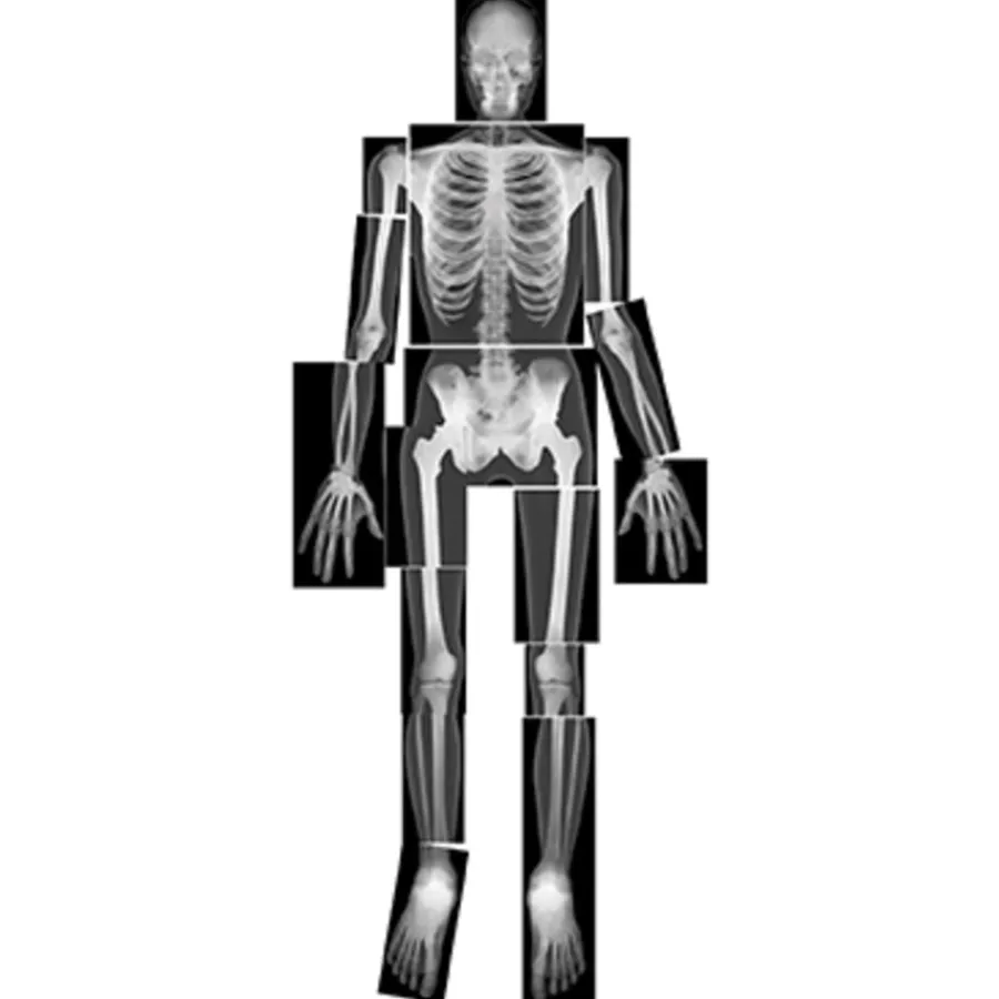 Discount Life-Size Human X-Rays Human Body|Technology